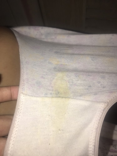 Normal??