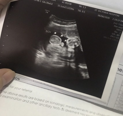 Expecting a girl but it’s a boy???!