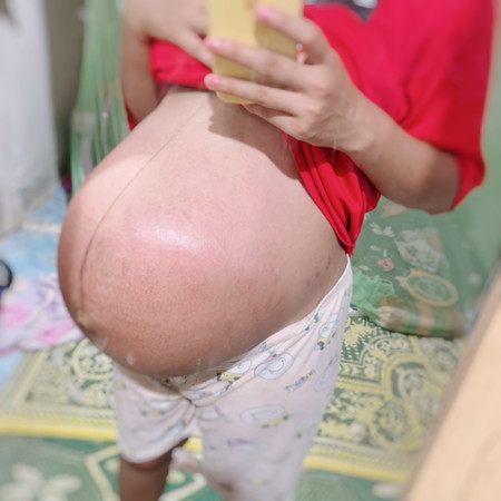 พรุ่งนี้ไปผ่าคลอดแล้วค่ะ ฝาแฝด