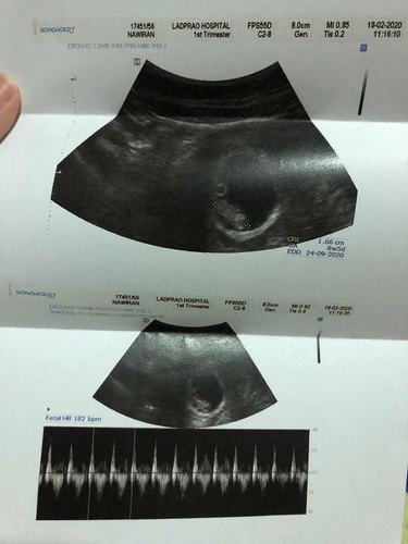 ฝากครรภ์ แบบแพ็กเกจ รพ.