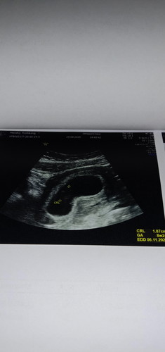 มีความกังวลคือว่าไปซาวด์มาวันนี้ที่คลีนิค...หมอบอกขนาดของเด็กใหญ่ขึ้นจากที่ซาวด์ครั้งแรกแต่ไม่เห็นหัวใจเด็กเต้น...