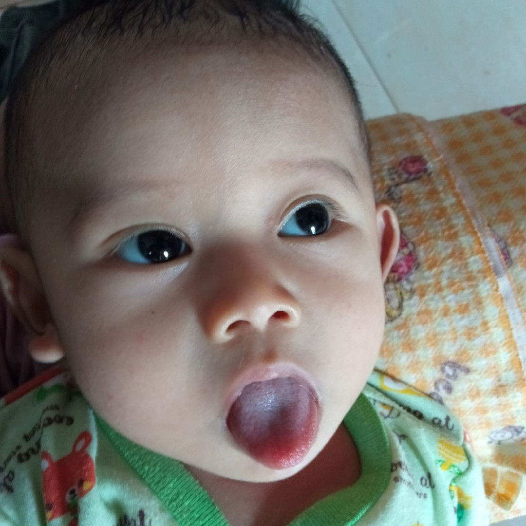 lidah bayi