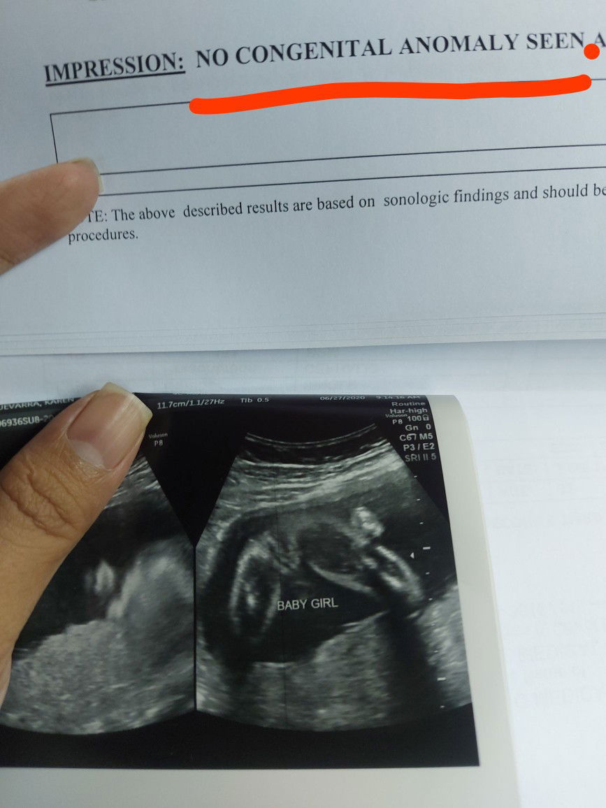 its a girl 🥳👧💞