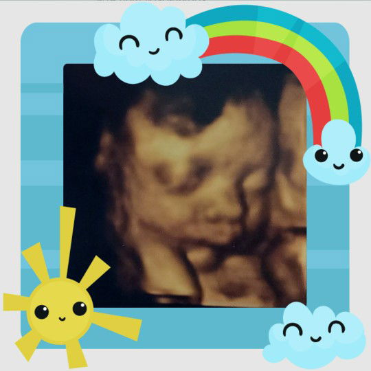 alx eukanne profile icon