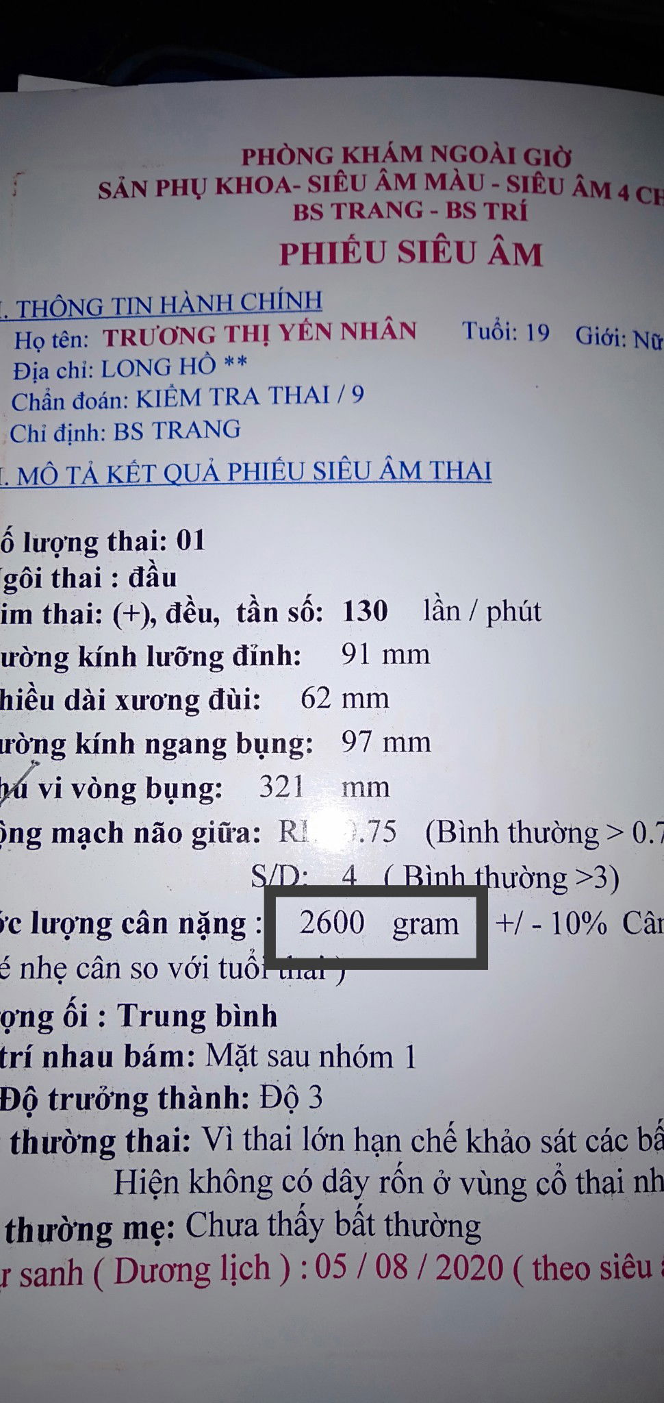 chỉ cách ăn vào con giúp e vs