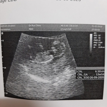 ลูกคนแรก