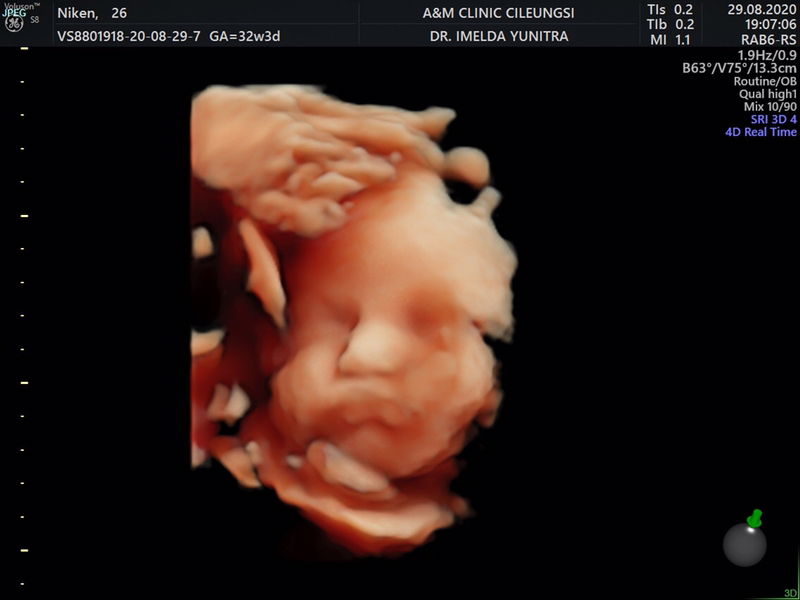 Niken A Supriatna profile icon