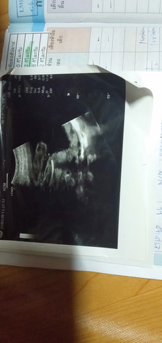 อยากรู้ว่าญหรือชค่ะ