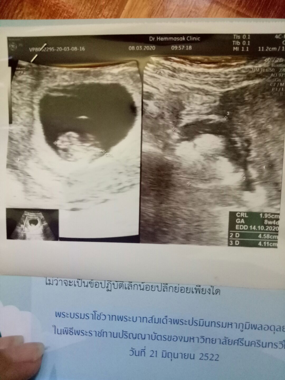 สิ่งไม่คาดคิด