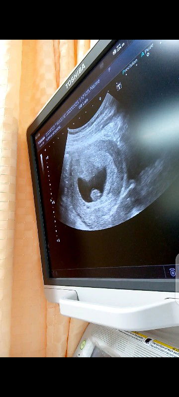 8w2d ท้องสองยังเห่ออยู่