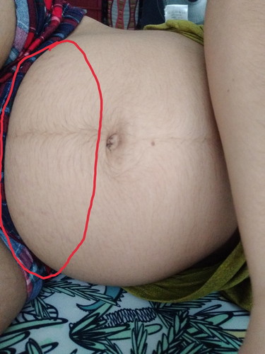 Lower Belly Pain