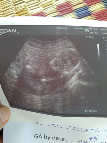 เด็กน้ำหนักน้อยกว่าเกณฑ์ค่ะ