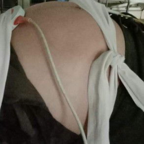 อัพเดตจากตอน5 เดือนมีภาวะรกเกาะต่ำค่ะ