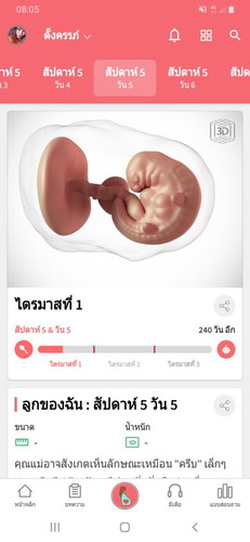 แม่บ้านใหนเป็นไมเกรนตอนท้องบ้าง