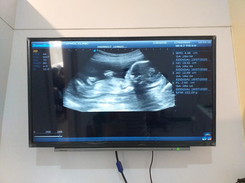 Baby?