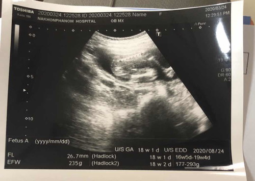 สอบถามหน่อยค่ะ