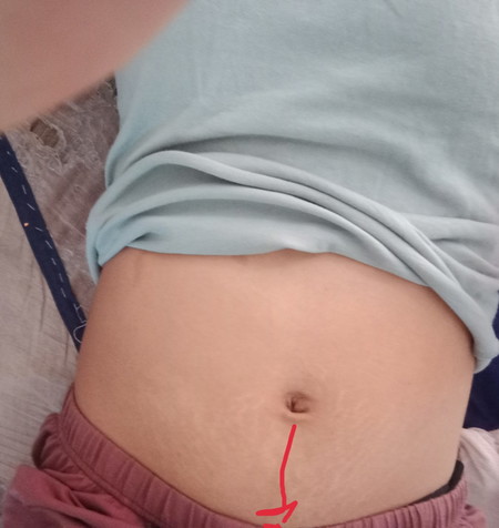 กังวนนิดหนึ่งขอคำปรึกษาค่ะ