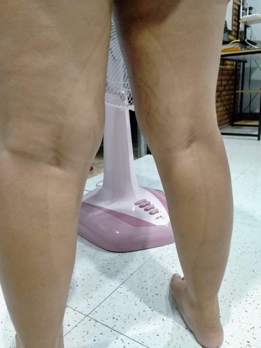 ขีดที่ขา