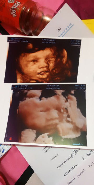 Shyabilla profile icon