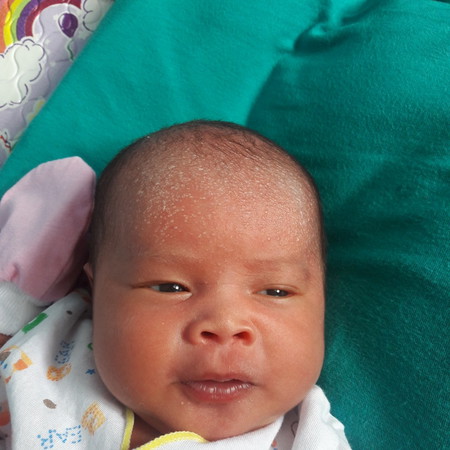 bintik bintik putih di kening dan kepala bayi 10hr