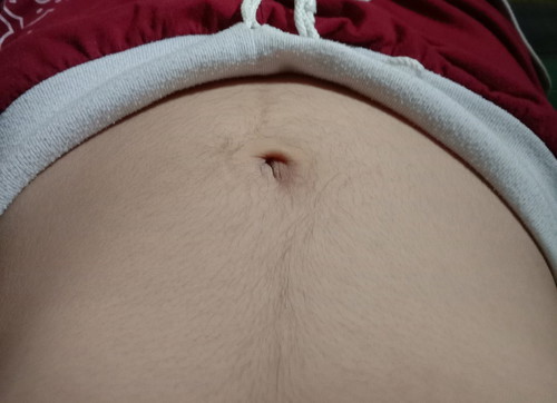 14W6D