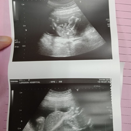 ลูกชายไหมค่ะช่วยดูหน่อย