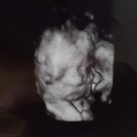 ลูกตัวเล็ก นน.ไม่ได้ทำไงดีค่ะ