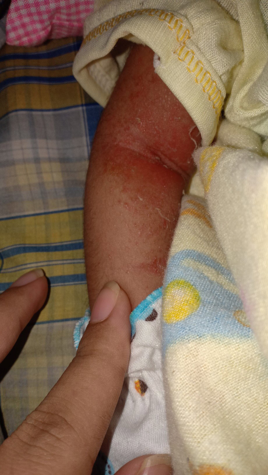 Bintik merah