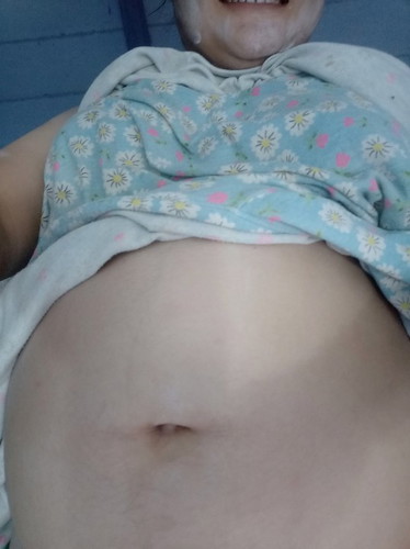 แม่ๆๆค่ะดูสะดืออย่างไงค่ะว่าลูกเราเป็นหญิงหรือชาย🤰🤰🤰🤰❤️