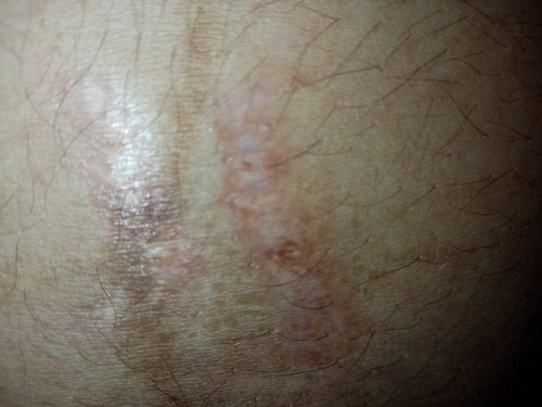 ใครรุ้้บ้างค่ะ ตรงนี้มันเป็นเพราะไรค่ะ.