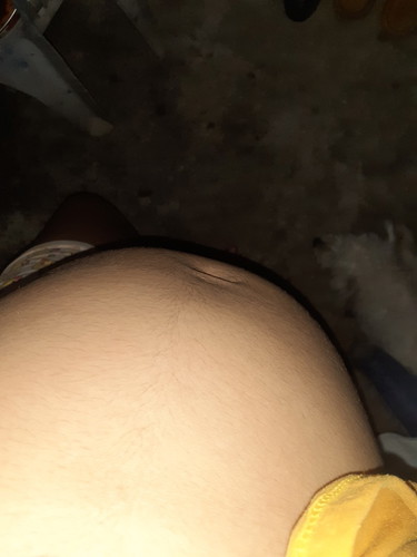 ?????