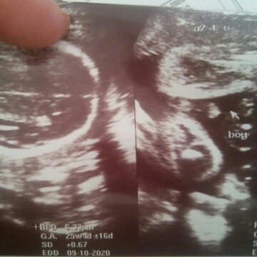 ultrasound