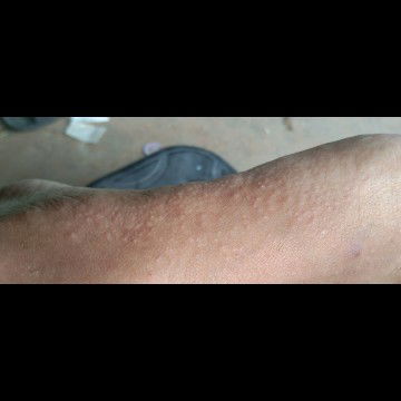 แม่ๆคนไหนใครเคยเป็นบ้าง