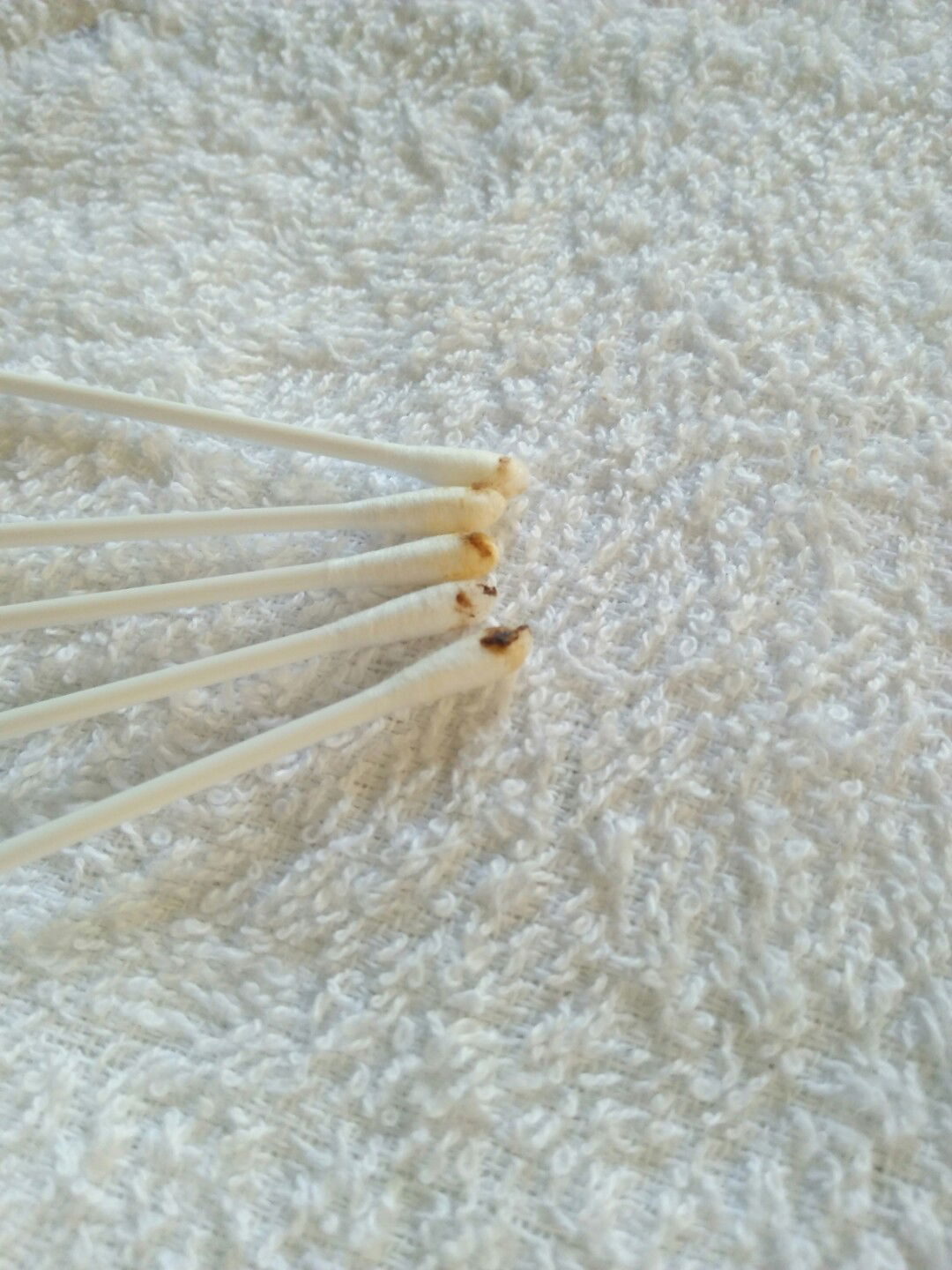 ขี้หูลูกเป็นสีดำปกติไหมค่ะ