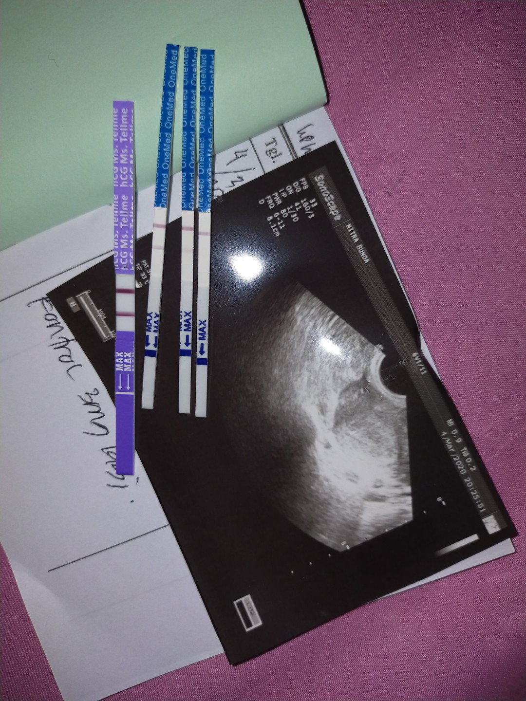 testpek positif tapi hasil usg belum terkihat kantungnya