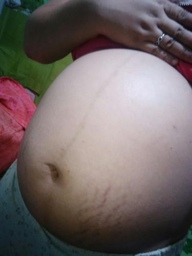 7month prggy???
