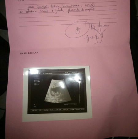 Kehamilan trimester pertama