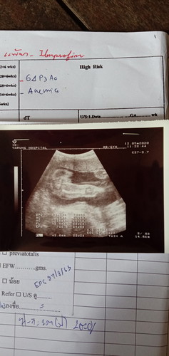 แม่ๆช่วยดูหน่อยได้ไหมคะว่า ญ หรือ ช