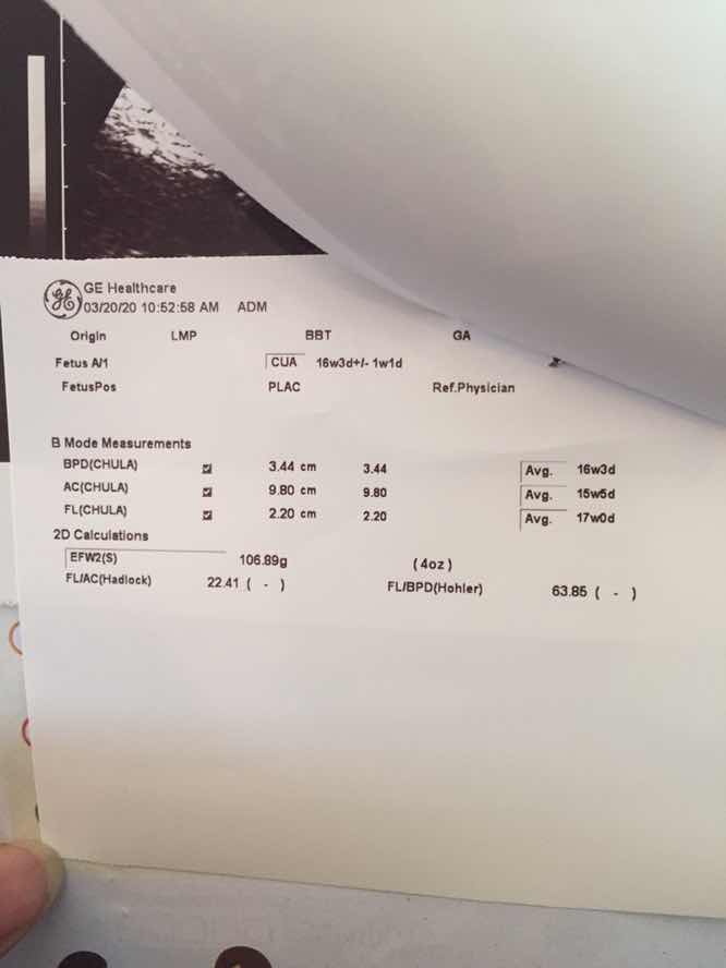 ถามผู้รู้ค่ะเกี่ยวกับใบที่ปริ้นมาจากเครื่องอัลตร้าซาวด์คะ ขอบคุนล่วงหน้านะค่ะถ้ามีผุ้แนาะนำและอธิบายได้ขอบคุนค่ะ