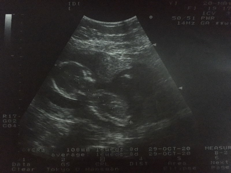 Wachiraya Fiat'zz profile icon