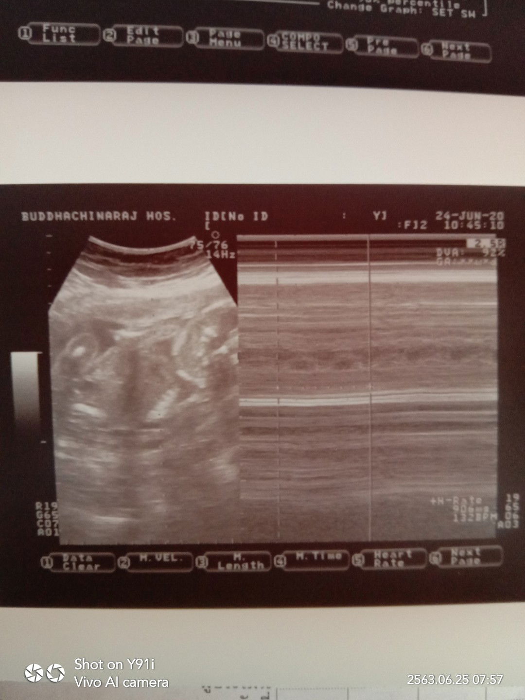 เจ็บแต่ทนได้