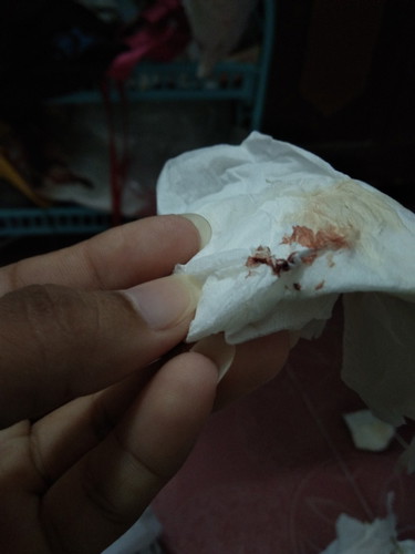 มีเลือดออก