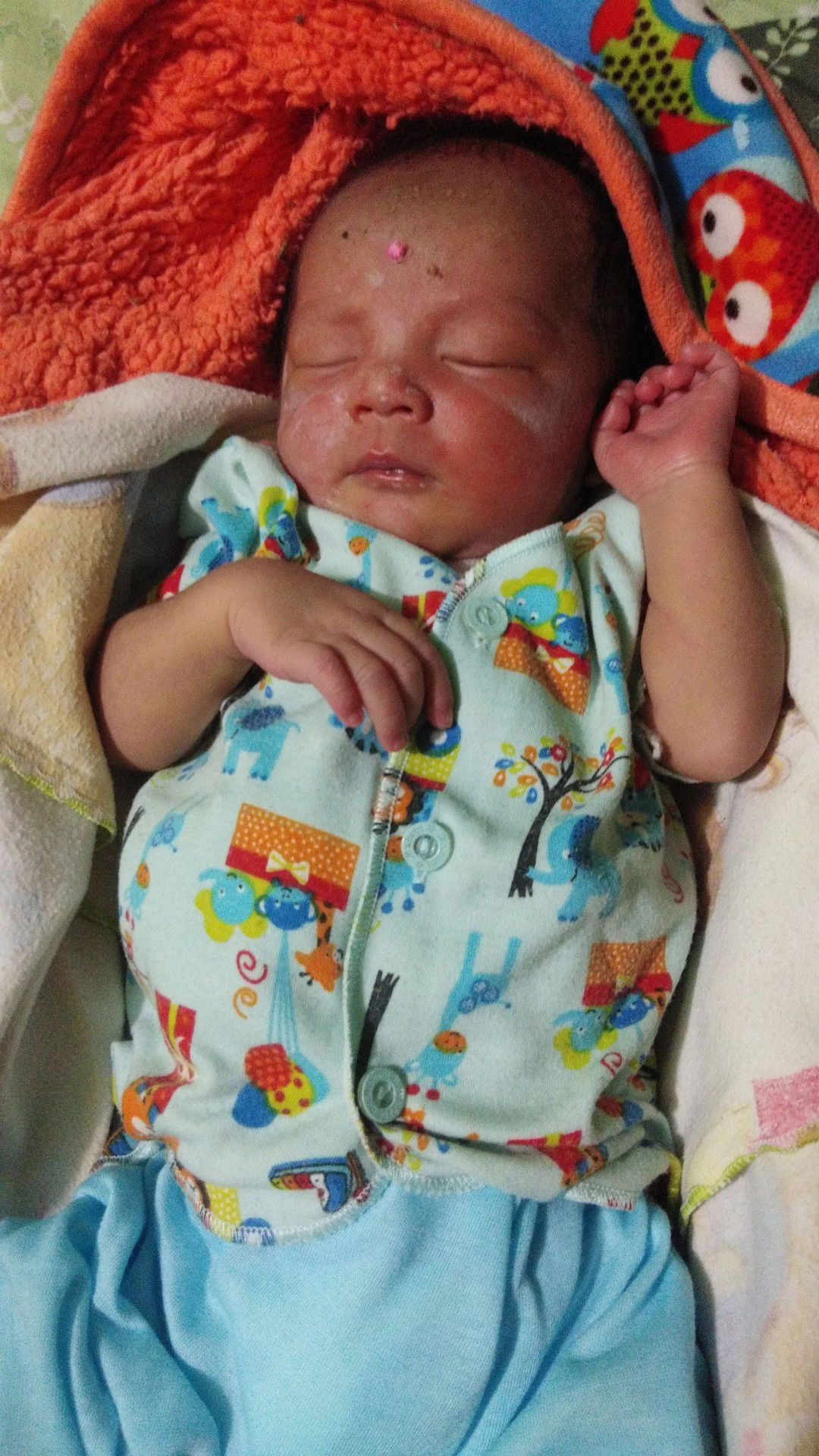 bayi kuning usia 5 hari