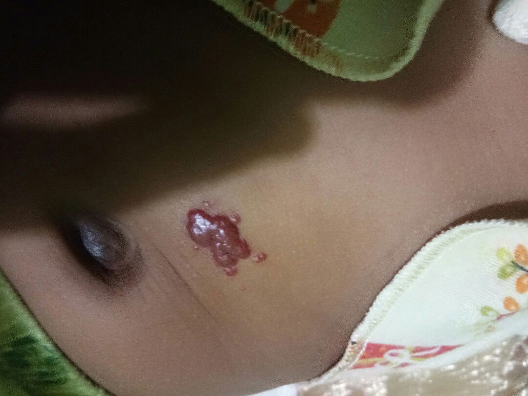 Tanda yang baru keluar setelah bayi lahir 10 hari