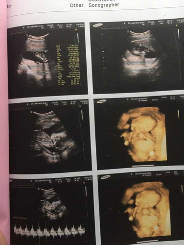 ซาวด์4มิติ กี่วิค ถึงจะเห็นหน้าลูกชัด ๆค่ะ ???