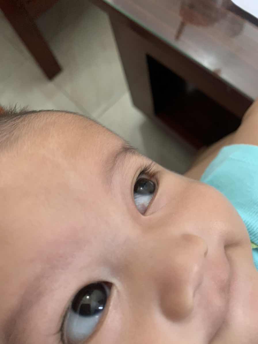 mata bayi ada bercak merah