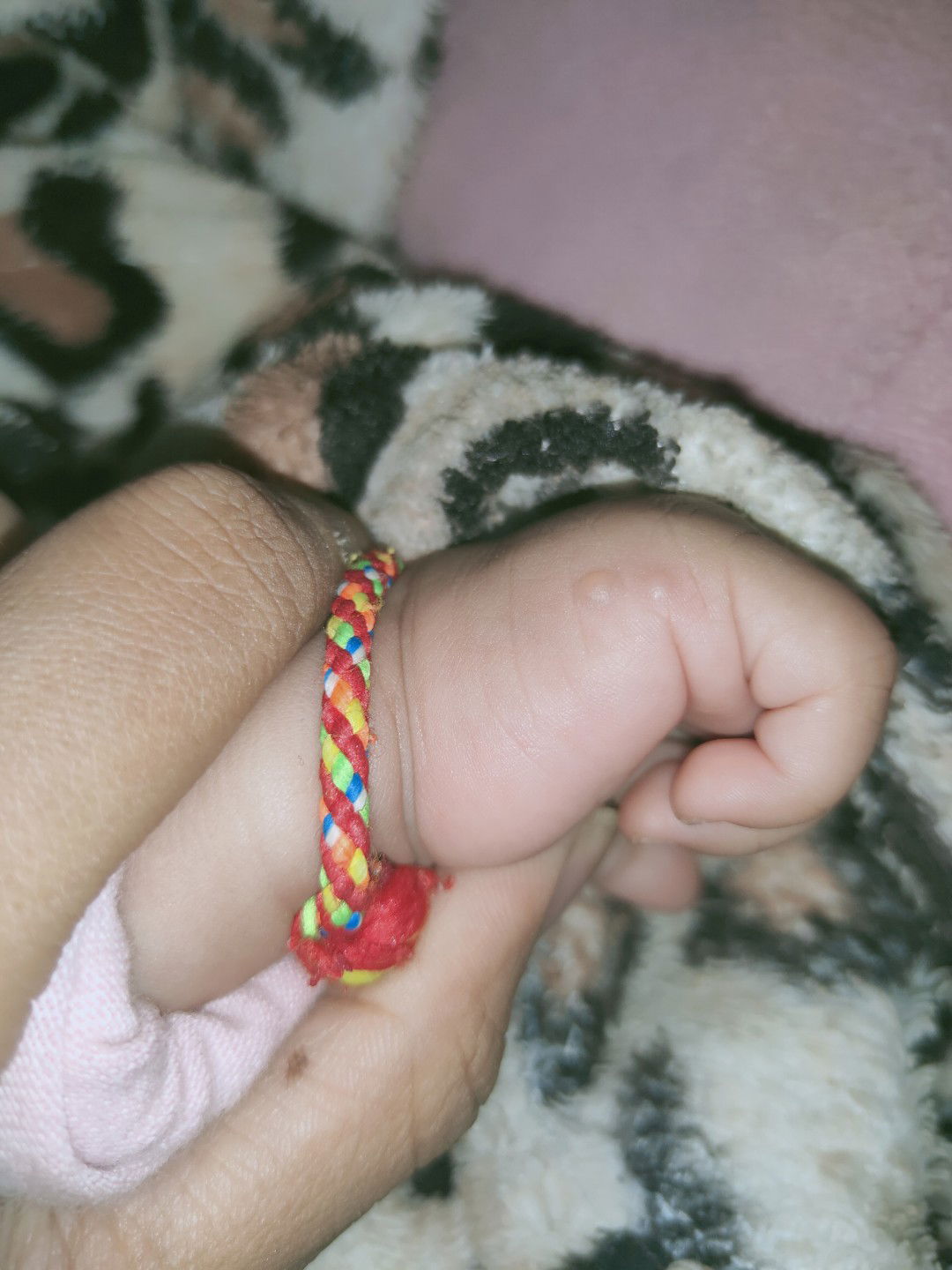 แม่ๆ. ตุ่มแบบนี้อันตรายมั้ยค่ะ