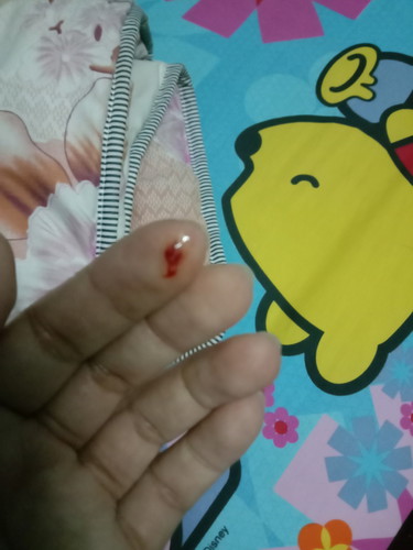 ปวดท้องน้อย หน่วงๆคะ แล้วมีเลือดออกมา นิดหนึ่ง