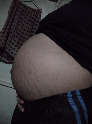 baby bump