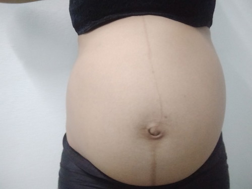 29 สัปดาห์ 3วัน